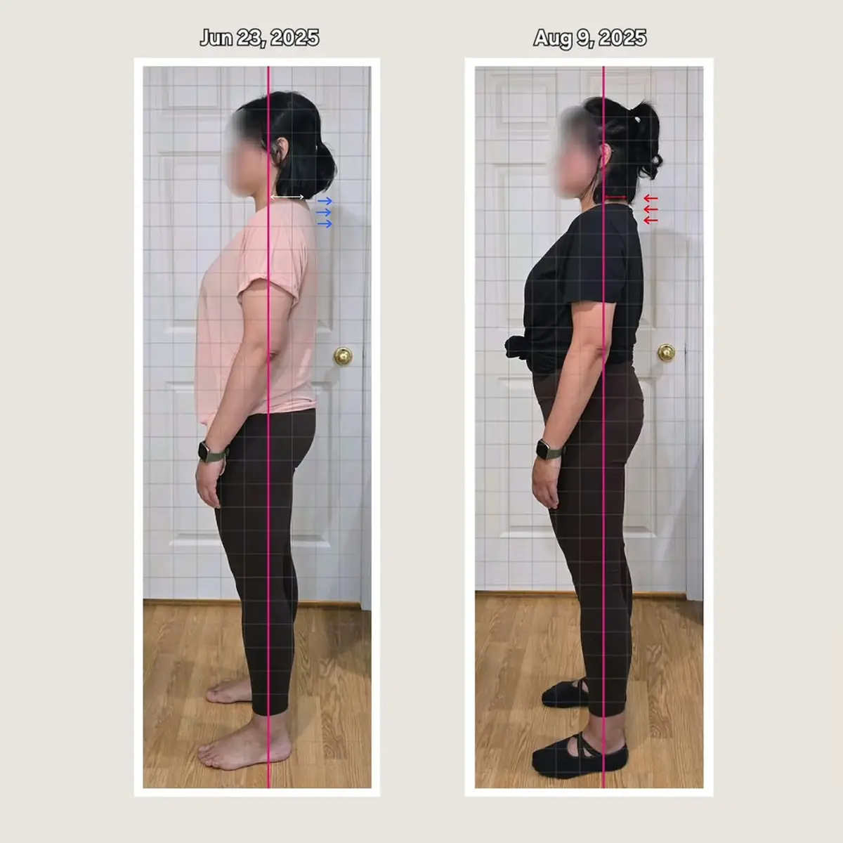 Client posture transformation before and after — a busy mother building strength and steadier posture — tap to view on Instagram