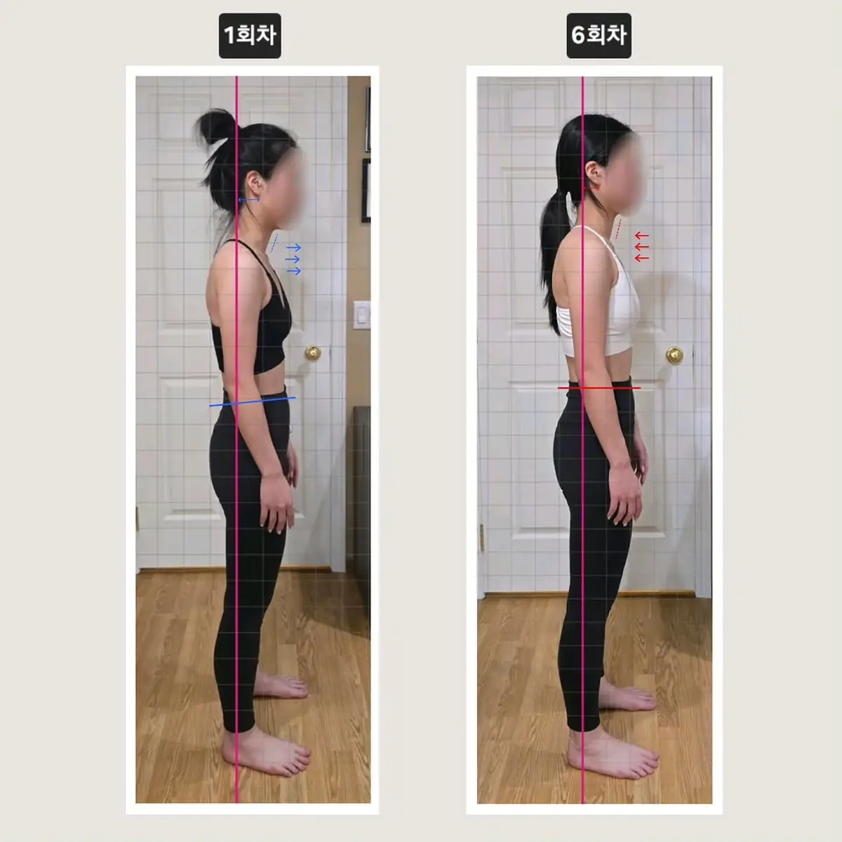 Client posture transformation before and after — six sessions, a more defined and balanced body line — tap to view on Instagram