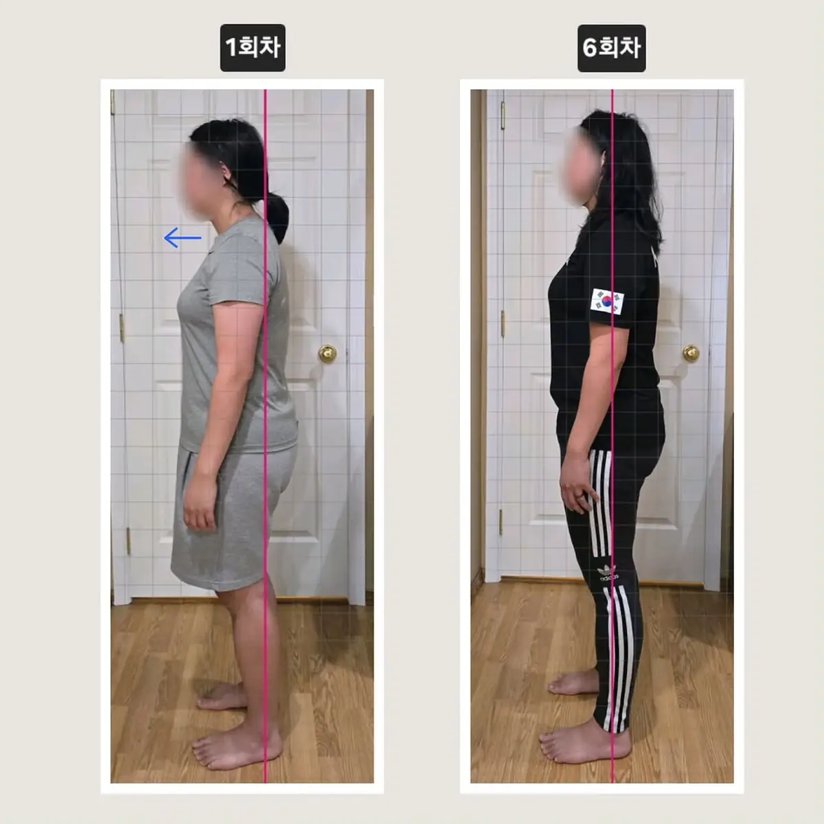 Client posture transformation before and after — six sessions, a forward lean straightened — tap to view on Instagram