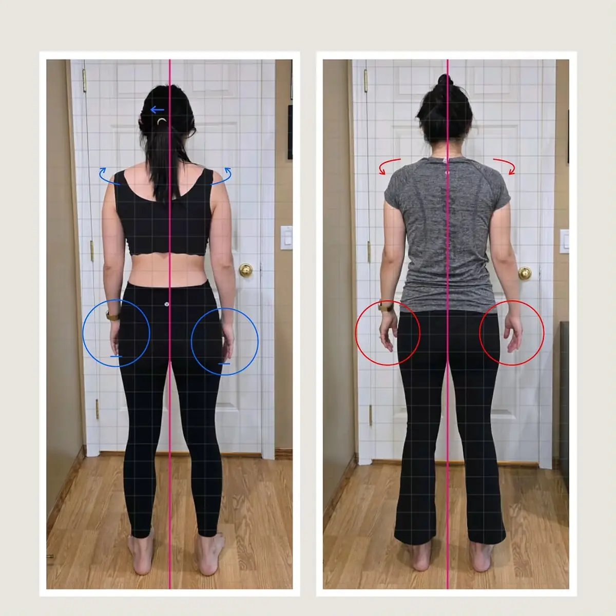 Client posture transformation before and after — twelve sessions, stronger and visibly more upright — tap to view on Instagram