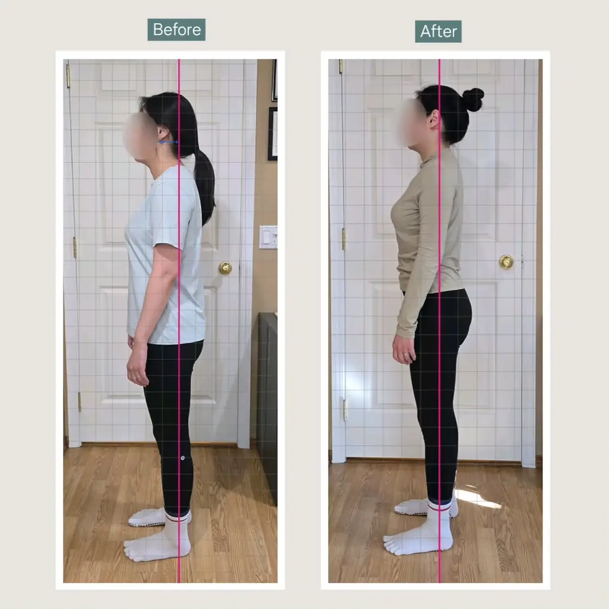 Client posture transformation before and after — ten sessions, shoulders and pelvis level, weight back over the centre line — tap to view on Instagram