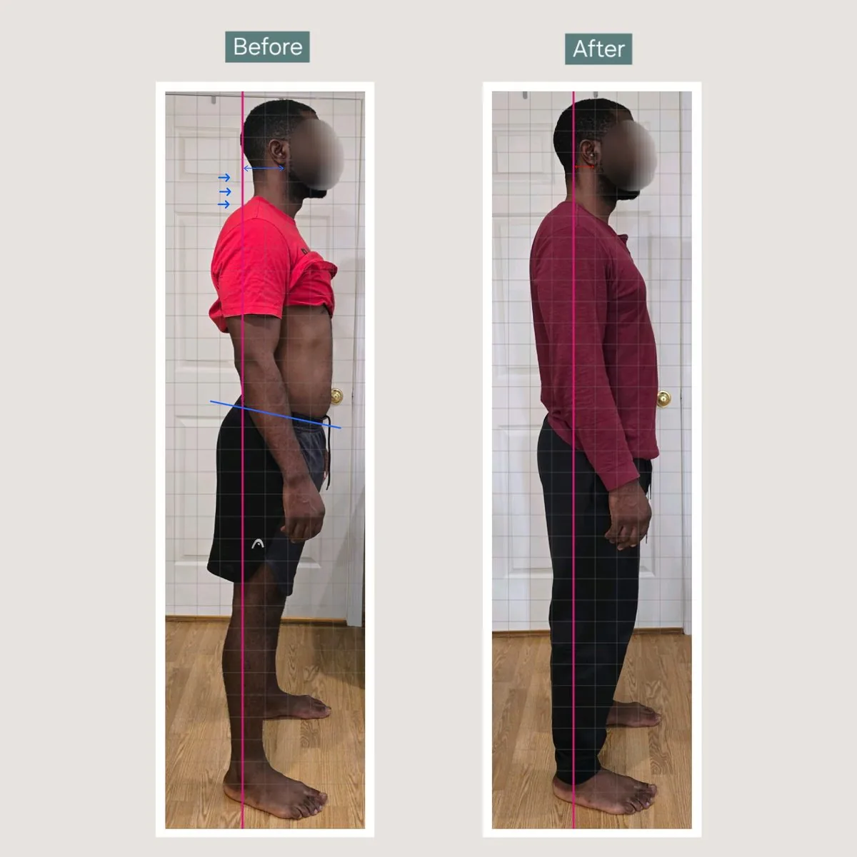 Client posture transformation before and after — standing taller and more aligned — tap for more on Instagram