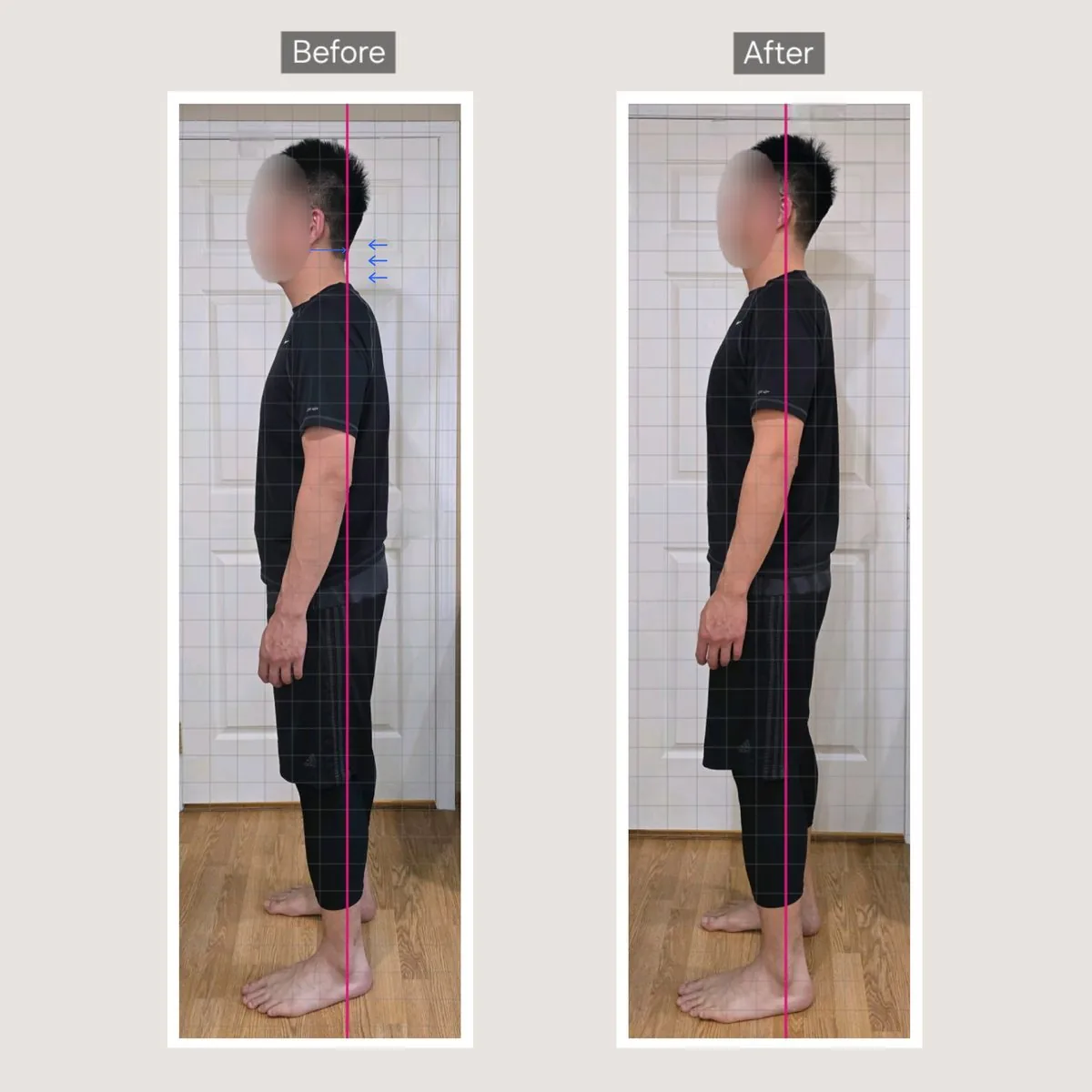 Client posture transformation before and after — shoulders level and relaxed — tap for more on Instagram