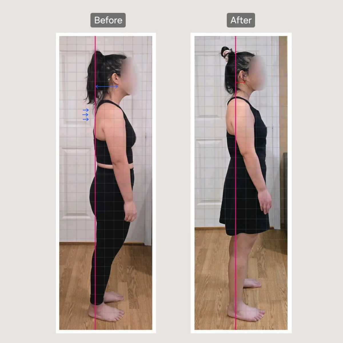 Client posture transformation before and after — head aligned over the spine — tap for more on Instagram