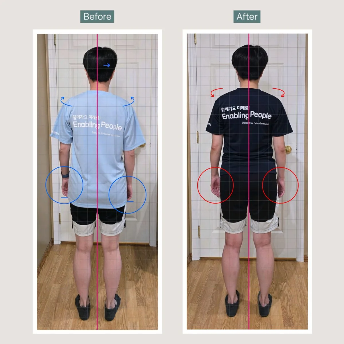 Client posture transformation before and after — forward head posture corrected — tap for more on Instagram