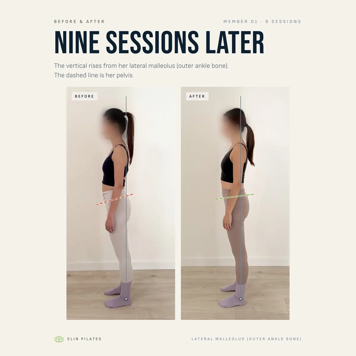 Client posture transformation before and after — nine sessions later, pelvis closer to level and chest open — tap to view on Instagram